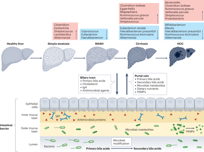 semaglutide gut microbiome Gut microbiome in metabolic dysfunction-associated steatotic liver disease  and associated hepatocellular carcinoma