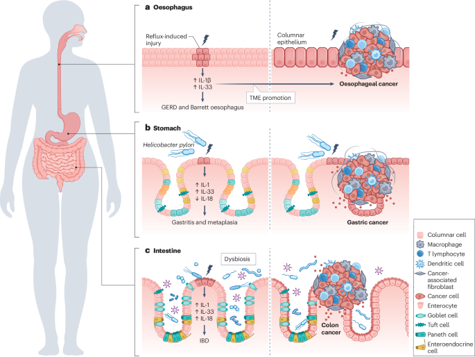 can you take glp-1 with gallstones Reconciling GLP-1s and Pancreatitis