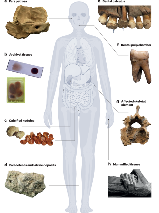 Ancient DNA insights into diverse pathogens and their hosts