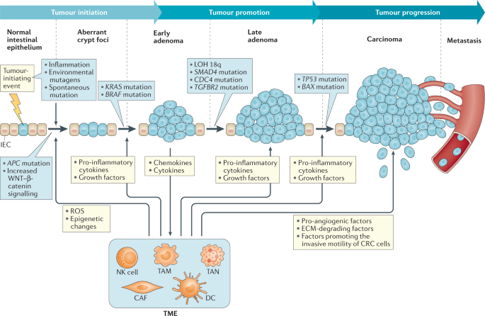 colorectal cancer pathogenesis)