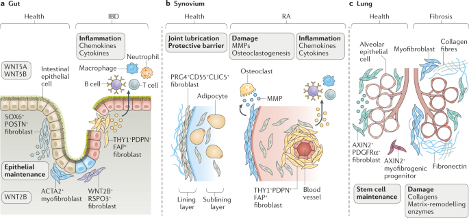 Fibroblasts as immune regulators in infection, inflammation and cancer