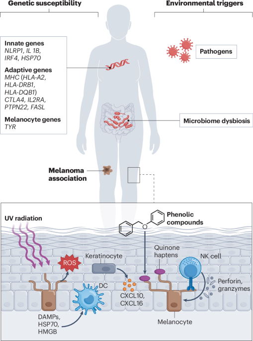 The immunology of vitiligo