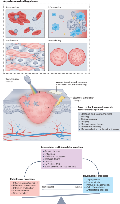 Wound management materials and technologies from bench to bedside 