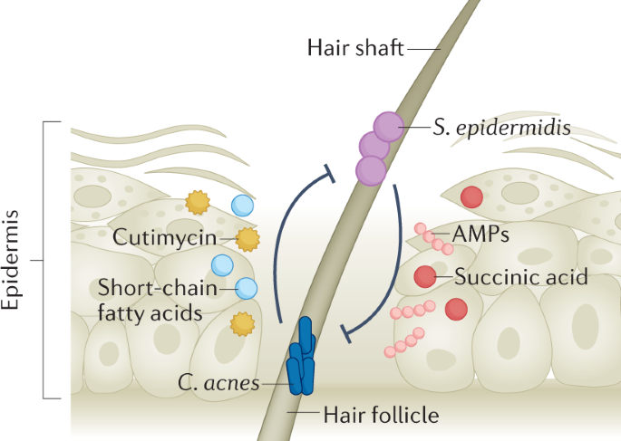 Staphylococcus epidermidis: Trends in Microbiology