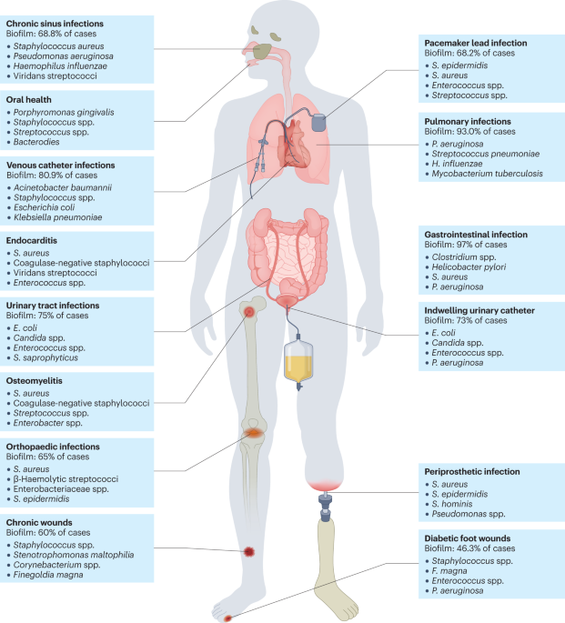 glutathione injection switzerland Glutathione IV Drip in Geneva