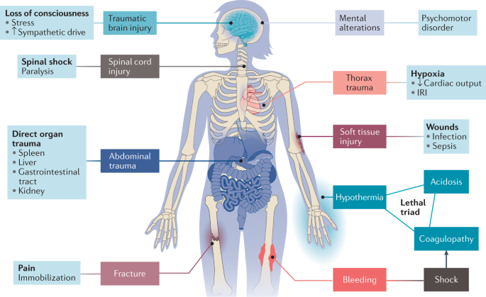 Immunopathophysiology of trauma-related acute kidney injury | Nature Reviews Nephrology Immunopathophysiology of trauma-related acute kidney injury | Nature Reviews Nephrology