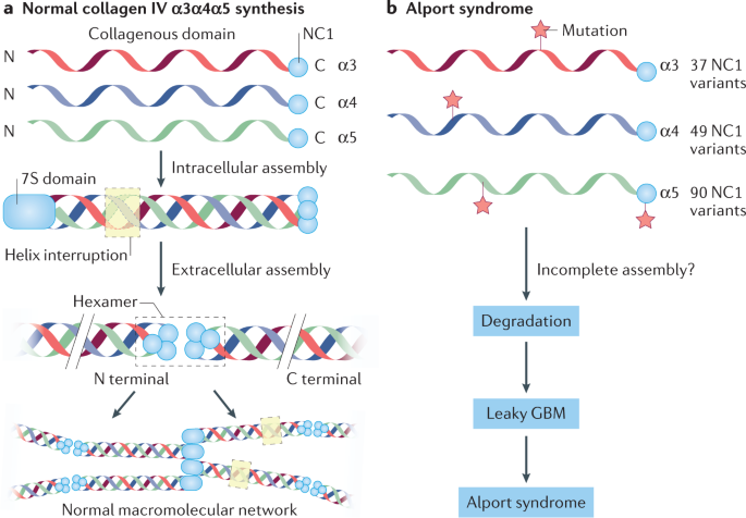 Complex Genetics Of Alport And Goodpasture Syndromes Nature Reviews Nephrology