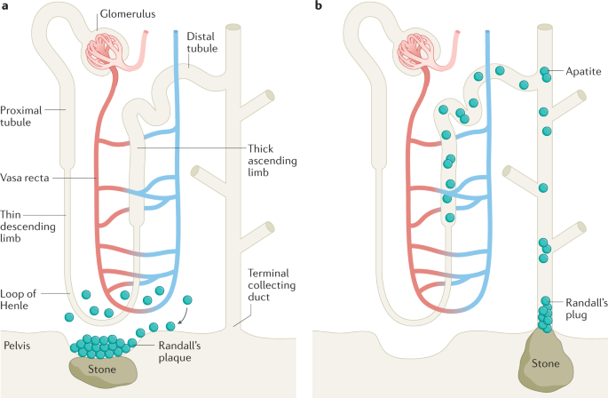 flank pain - Hum NEWS