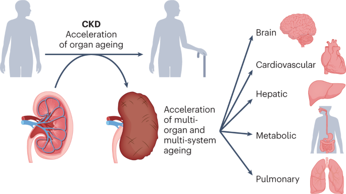 Chronic kidney disease promotes ageing in a multiorgan disease network