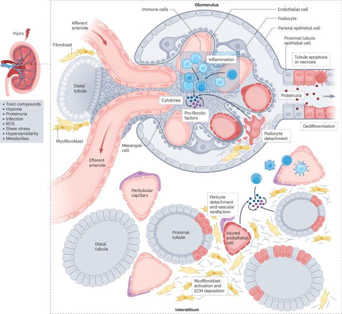 Metabolism at the crossroads of inflammation and fibrosis in chronic kidney  disease