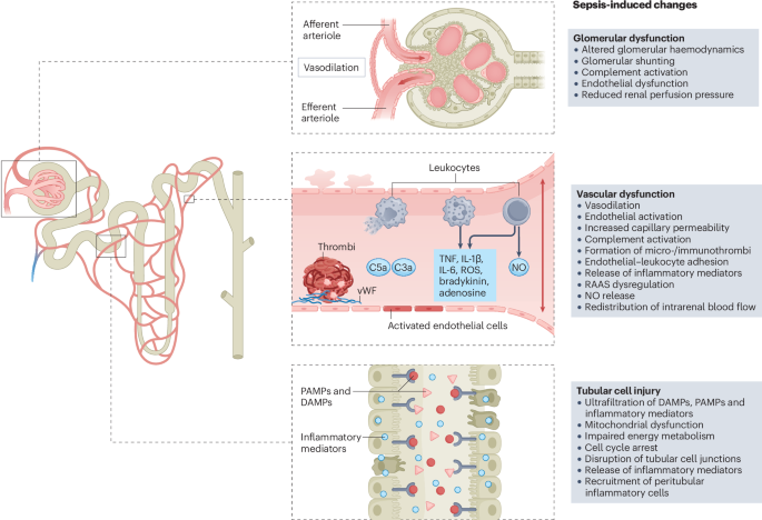 Sepsis criteria and kidney function: eliminating sex, age and economic status biases