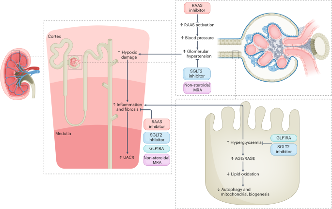 tirzepatide and kidney issues Next-generation therapeutics for diabetic kidney disease
