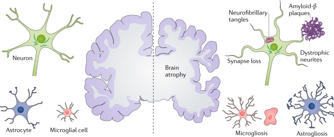 Tau-targeting therapies for alzheimer disease