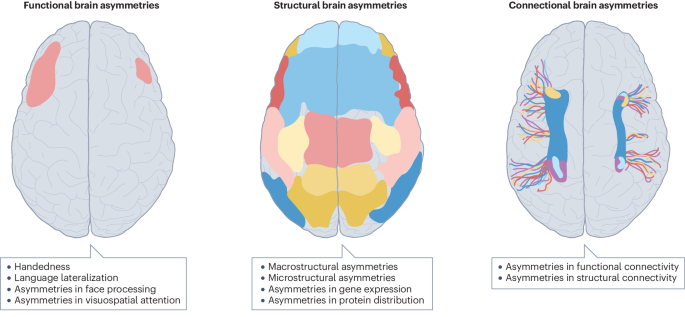 Clinical implications of brain asymmetries - Nature Reviews Neurology