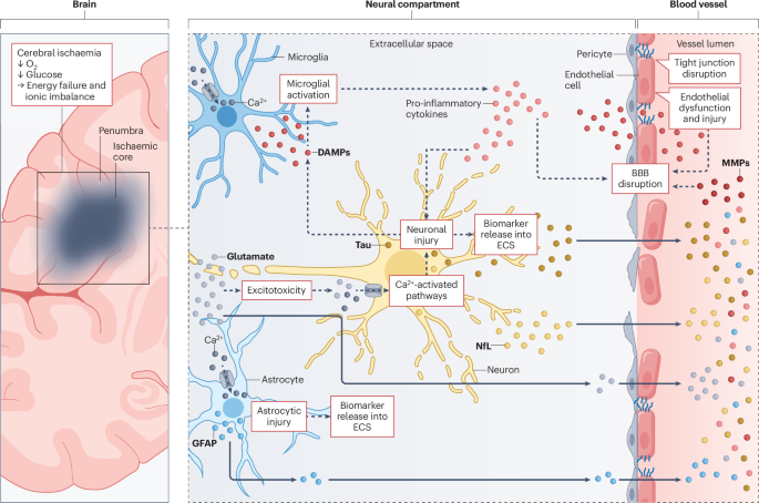 A roadmap towards clinical use of molecular biomarkers in acute ischaemic stroke