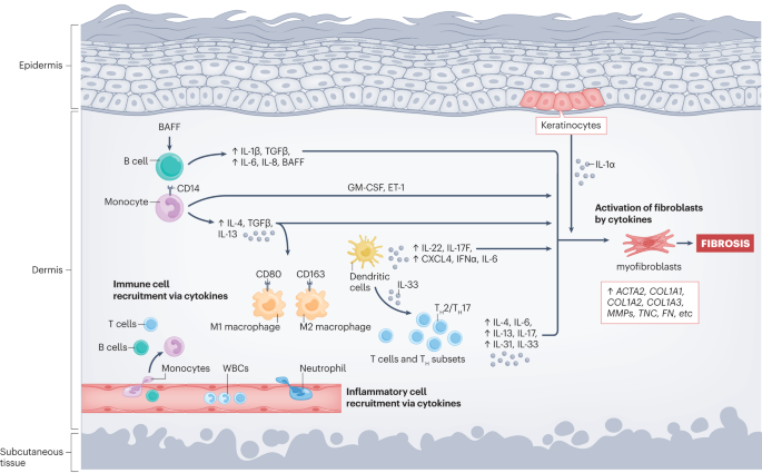 Back to the future: targeting the extracellular matrix to treat systemic sclerosis