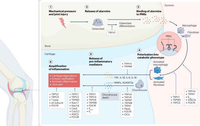 Ion channels in osteoarthritis: emerging roles and potential targets | Nature Reviews Rheumatology Ion channels in osteoarthritis: emerging roles and potential targets | Nature Reviews Rheumatology