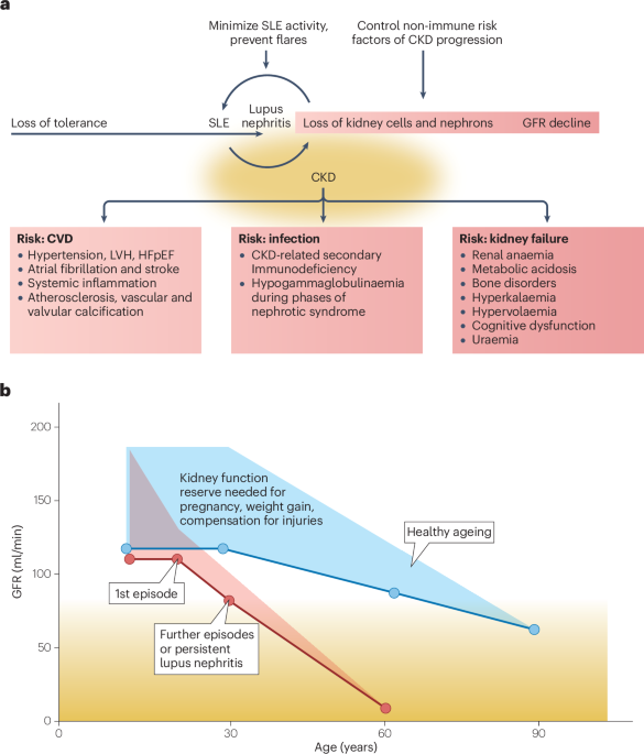 lupus and semaglutide Lupus nephritis-related chronic kidney disease