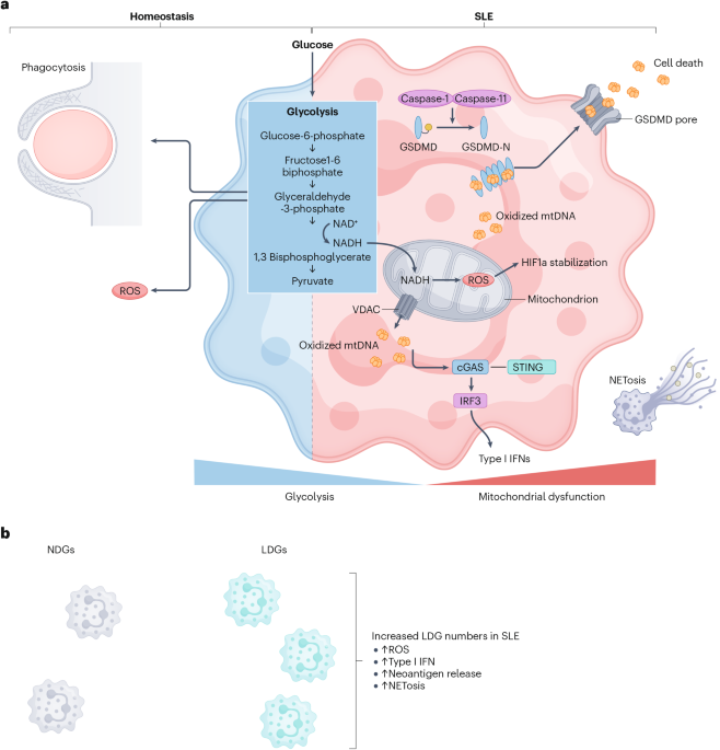 glutathione lupus reddit Immunometabolism in systemic lupus erythematosus