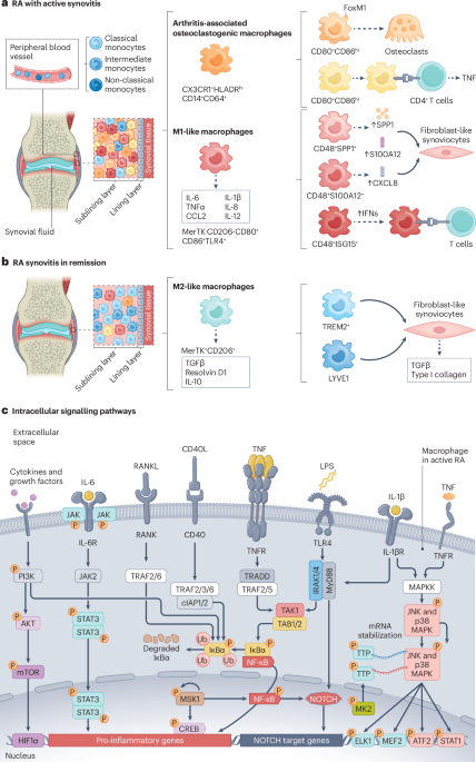 Dynamic macrophage phenotypes in autoimmune and inflammatory rheumatic ...