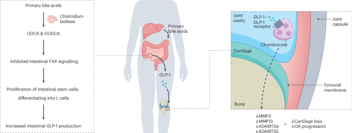 Glucagon-like peptide-1 receptor agonists in arthritis: current insights  and future directions
