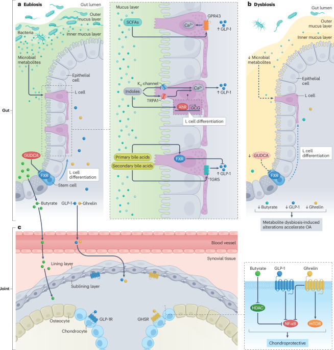 The gutjoint axis in osteoarthritis | Nature Reviews Rheumatology