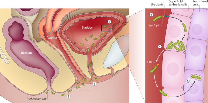 kezelése gangremen diabetes mellitus