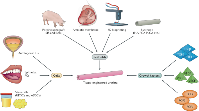 Regenerative And Engineered Options For Urethroplasty Nature Reviews Urology Regenerative And Engineered Options For Urethroplasty Nature Reviews Urology