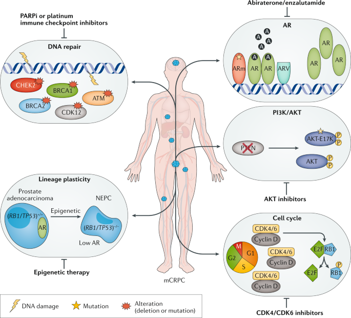 prostate cancer review nature