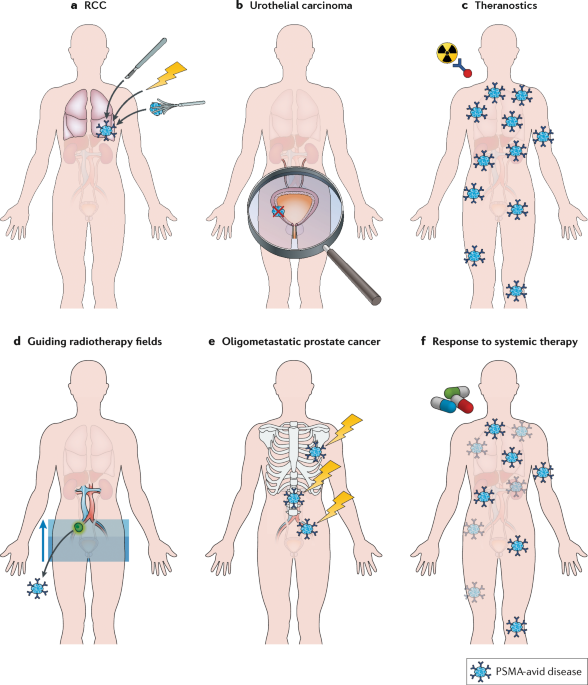 Expanding the role of small-molecule psma ligands beyond pet staging of prostate cancer