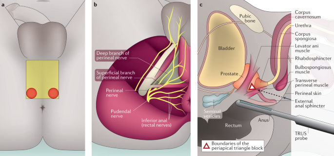 Biopsy on prostate