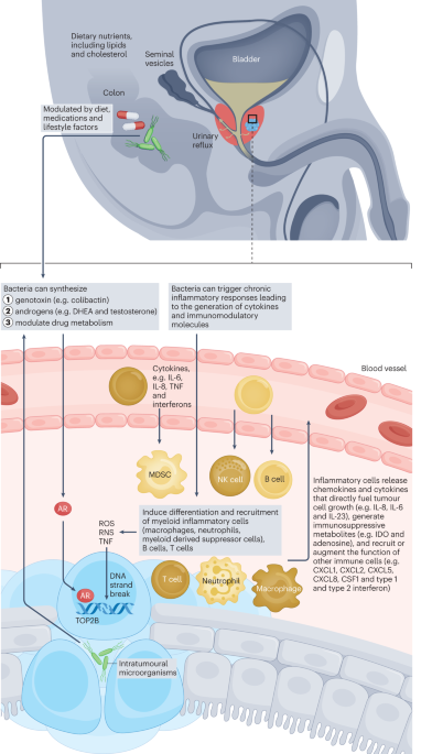 The potential role of the microbiota in prostate cancer pathogenesis and  treatment | Nature Reviews Urology
