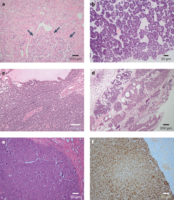 Renal mass biopsy — a practical and clinicopathologically relevant