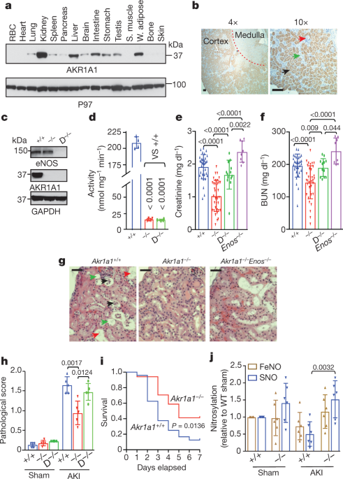 Risultati immagini per Metabolic reprogramming by the S-nitroso-CoA reductase system protects against kidney injury, Nature (2018)