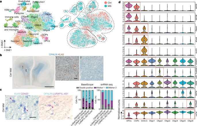 Altered Human Oligodendrocyte Heterogeneity In Multiple Sclerosis Nature Altered Human Oligodendrocyte Heterogeneity In Multiple Sclerosis Nature