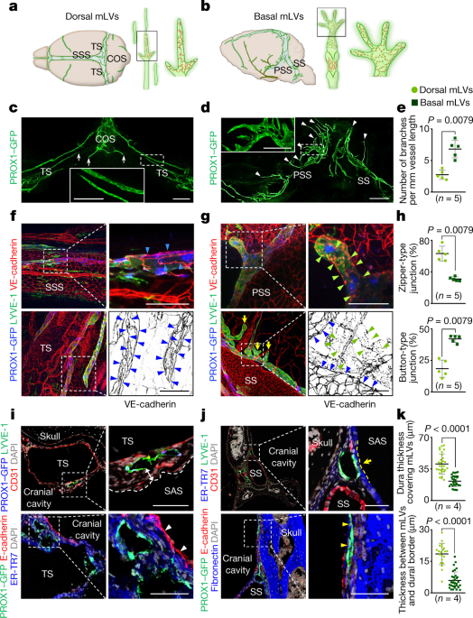 Meningeal Lymphatic Vessels At The Skull Base Drain