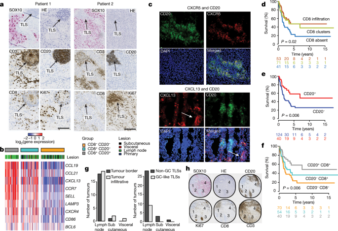 Tertiary lymphoid structures improve immunotherapy and survival in melanoma