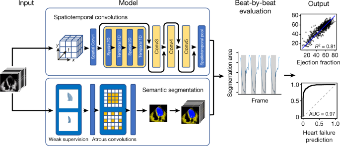 Video-based AI for beat-to-beat assessment of cardiac function | Nature