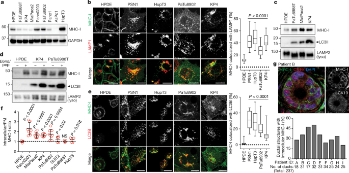 Autophagy Promotes Immune Evasion Of Pancreatic Cancer By Degrading Mhc I Nature