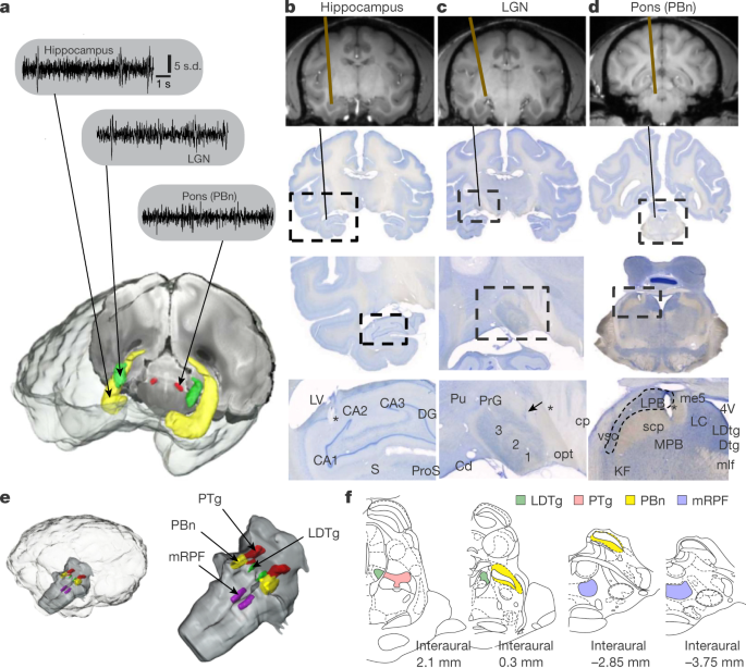 Coupling Of Hippocampal Theta And Ripples With Pontogeniculooccipital Waves Nature