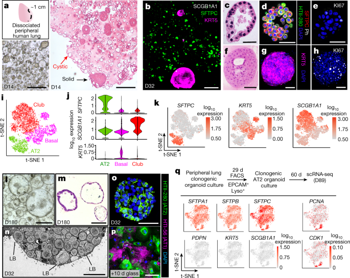 Progenitor identification and SARS-CoV-2 infection in human distal lung organoids