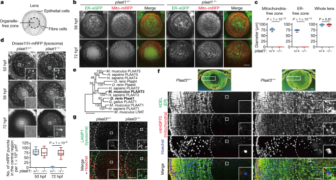 Organelle Degradation In The Lens By Plaat Phospholipases Nature Organelle Degradation In The Lens By Plaat Phospholipases Nature