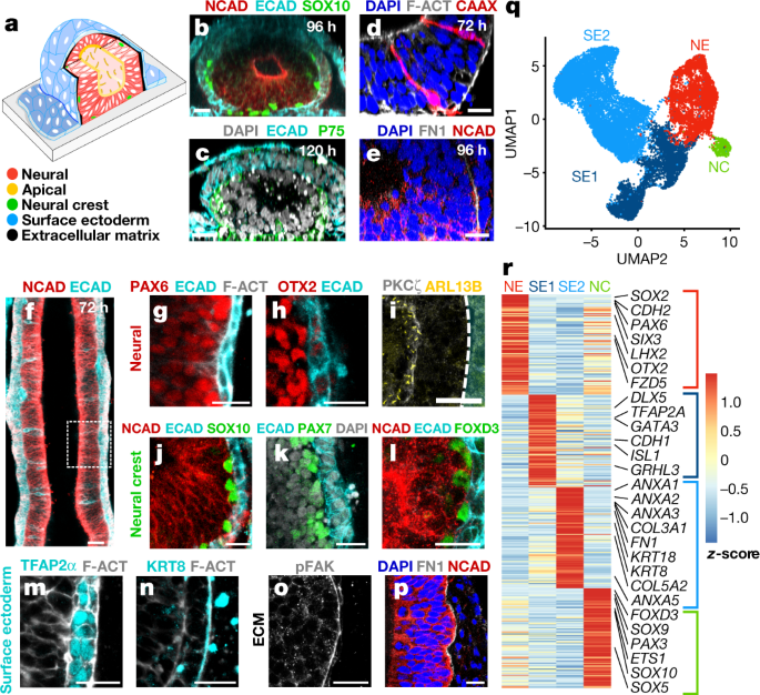 Frontiers  Pax3/7 regulates neural tube closure and patterning in