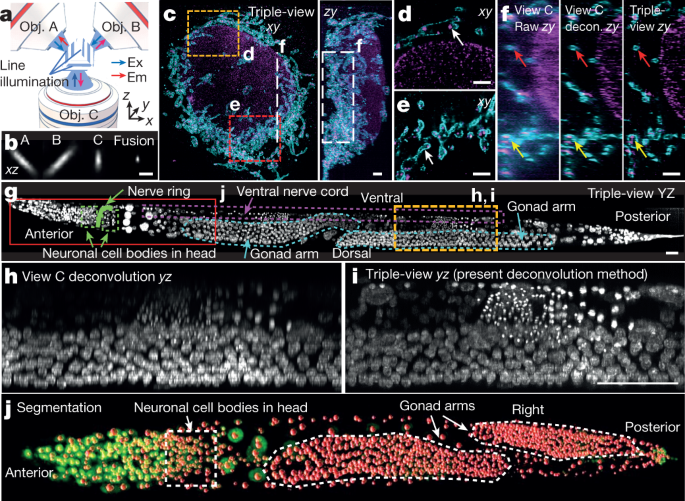 Multiview confocal super-resolution microscopy