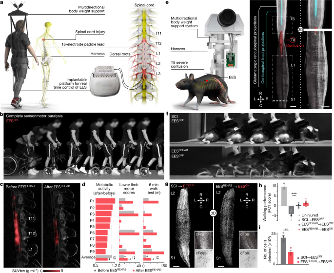 The neurons that restore walking after paralysis