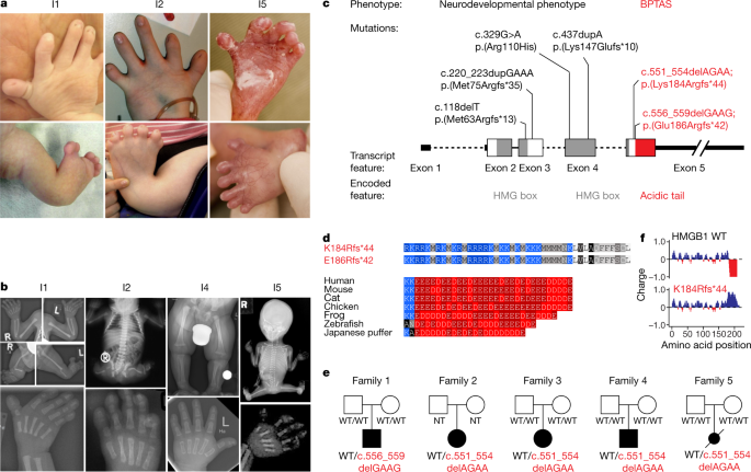 Aberrant phase separation and nucleolar dysfunction in rare genetic  diseases | Nature