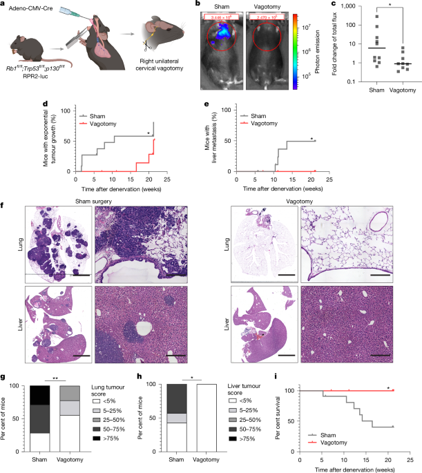 Neuronal activity-dependent mechanisms of small cell lung cancer pathogenesis