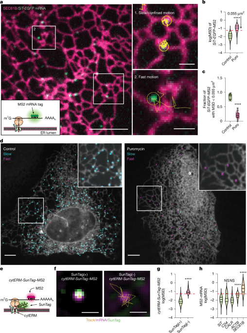Secretome translation shaped by lysosomes and lunapark-marked ER junctions