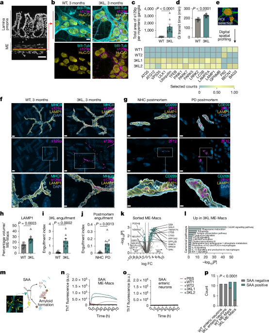 Intestinal macrophages modulate synucleinopathy along the gut-brain axis - Nature