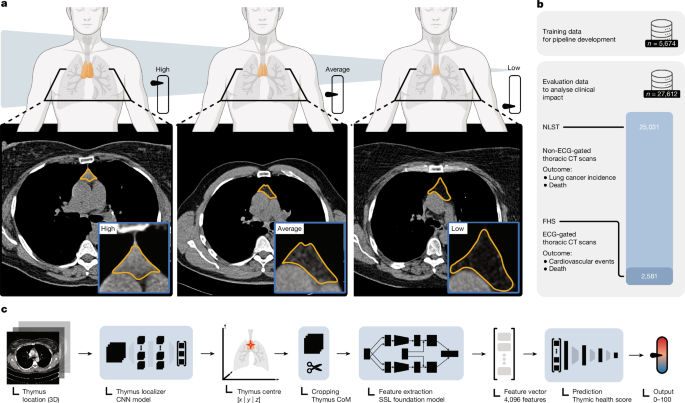 Thymic health consequences in adults - Nature